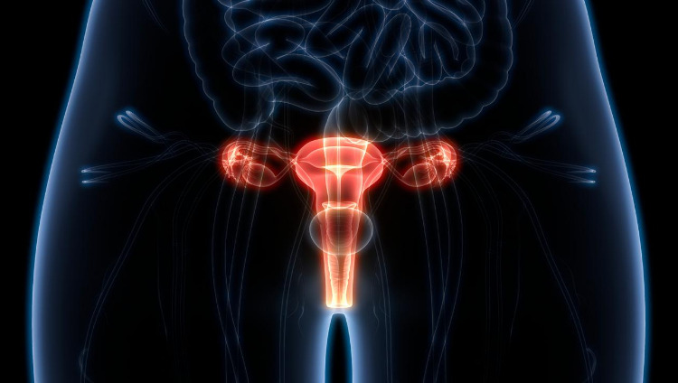 Rahimdeki Endometrial polip nedir, nasıl tedavi edilir?